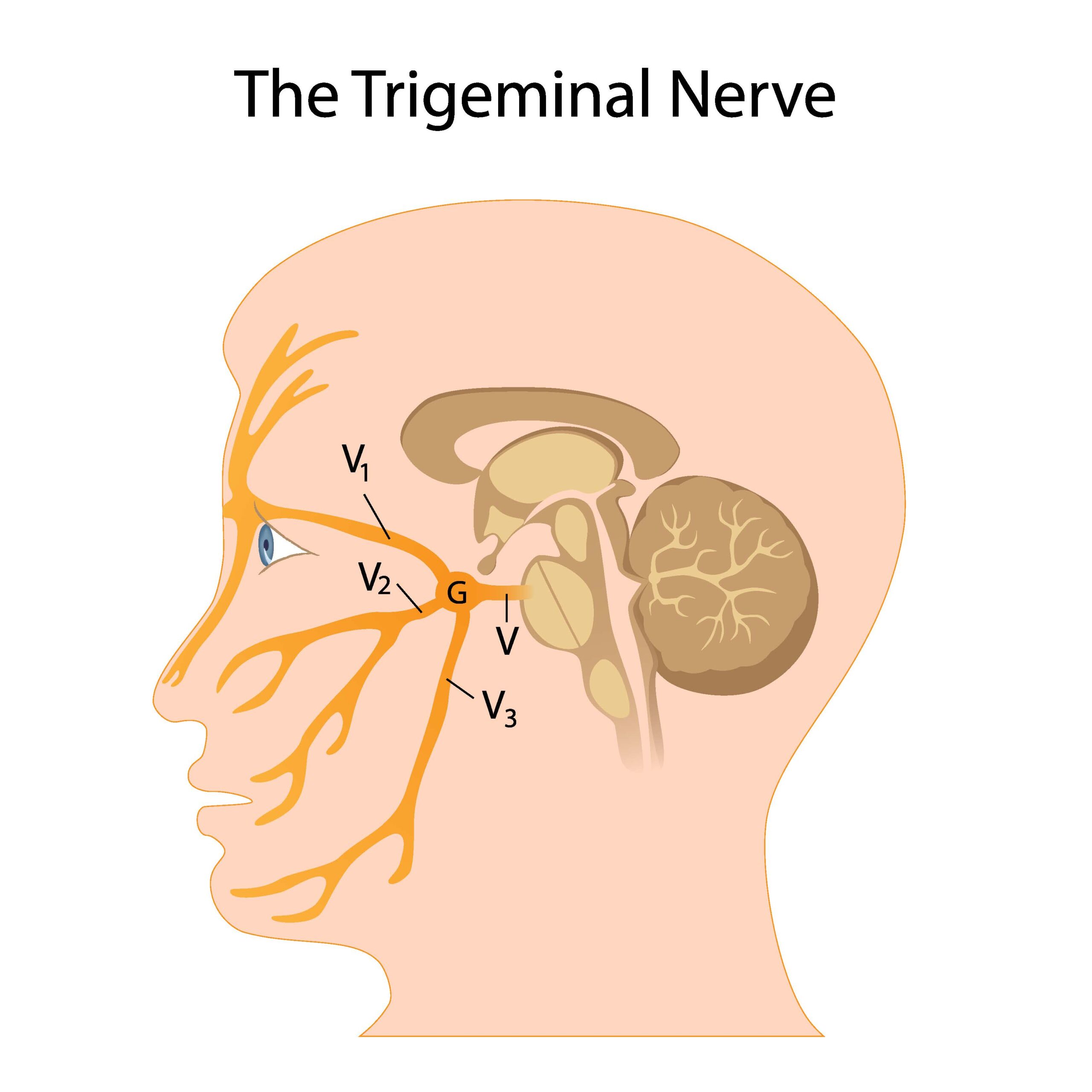Trigeminal neuralgia
