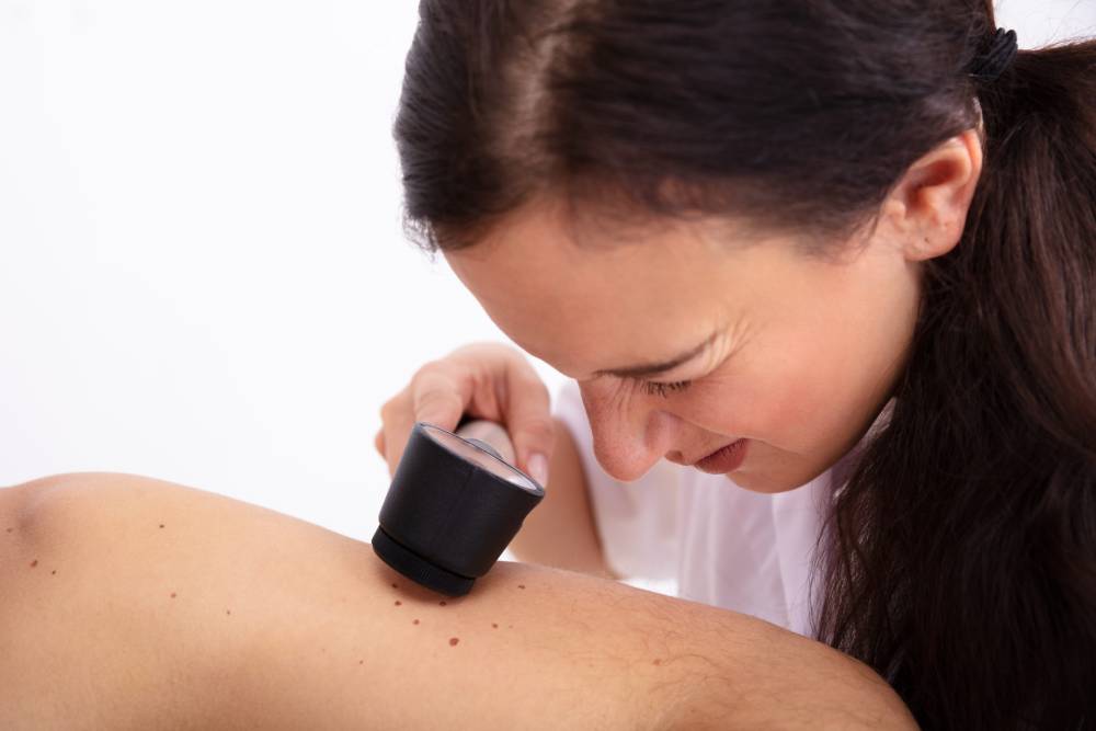 Skin Cancer in Phoenix