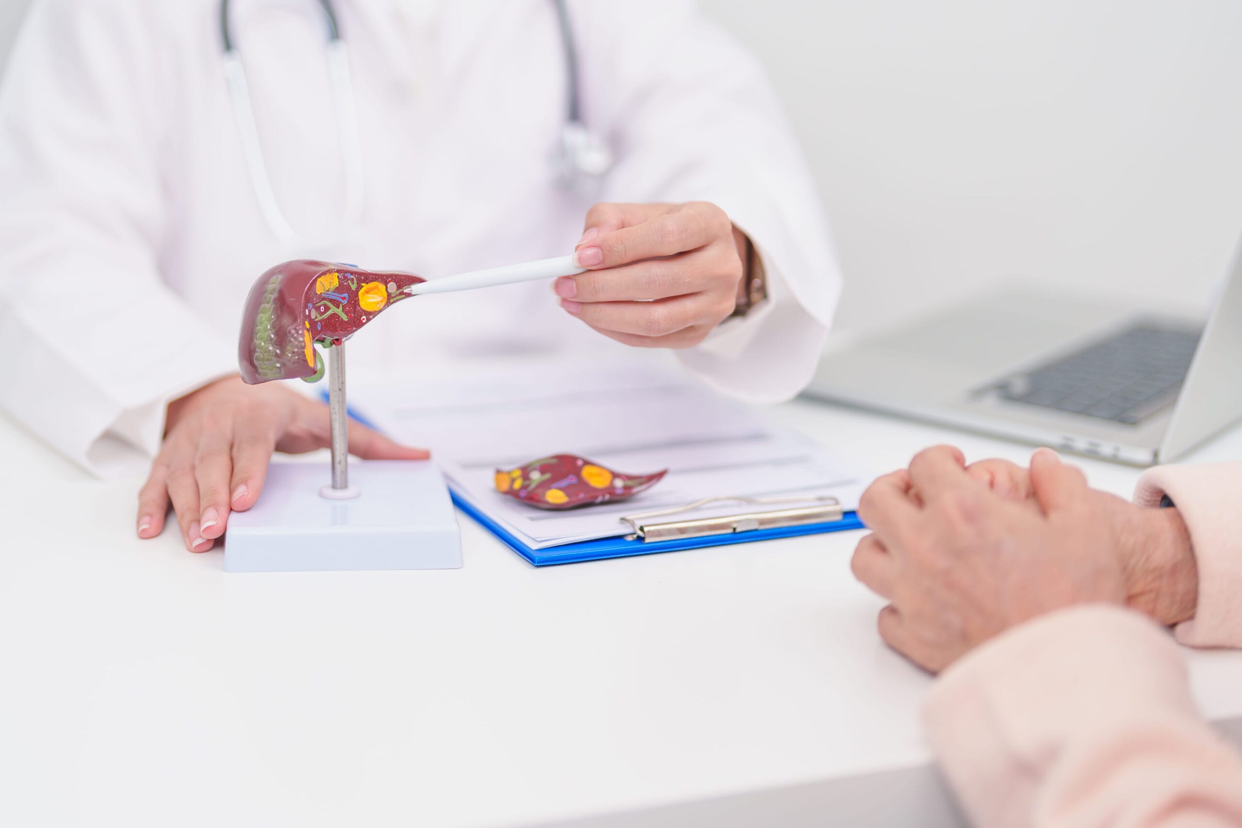 Doctor explaining liver cancer treatment options to a patient using an anatomical liver model.