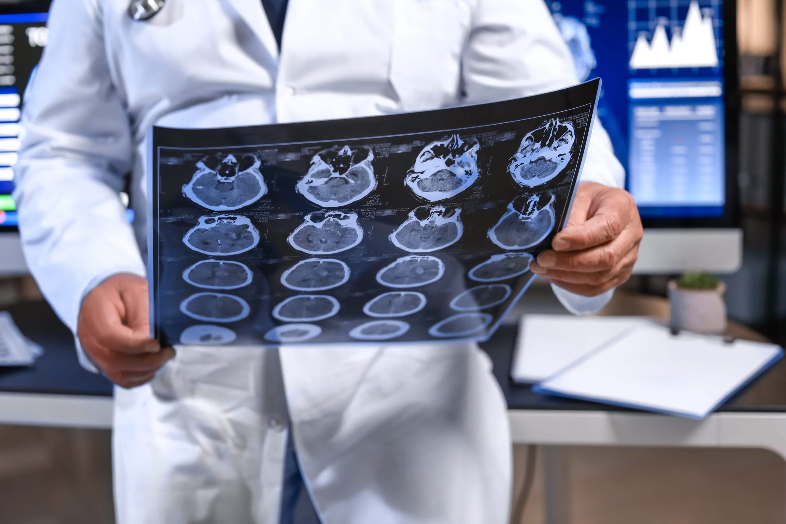 Doctor reviewing a patient's brain MRI scans